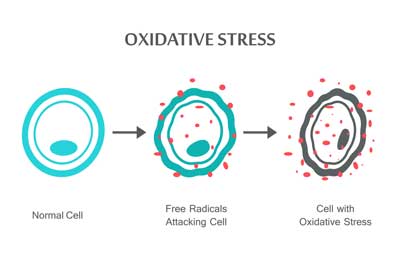 oxidative stress