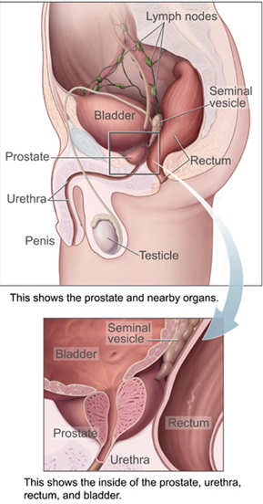 Prostate Diagram